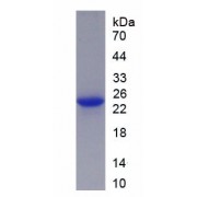 SDS-PAGE analysis of recombinant Human PGR Protein.