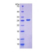 SDS-PAGE analysis of Mouse ITGa3 Protein.