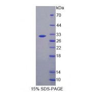 SDS-PAGE analysis of Human AGRN Protein.