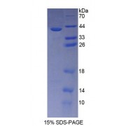 SDS-PAGE analysis of Human CDH5 Protein.