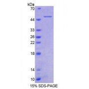 SDS-PAGE analysis of Human TNFRSF1B Protein.