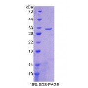 SDS-PAGE analysis of Human CHRNb2 Protein.