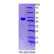 SDS-PAGE analysis of Human NAIP Protein.