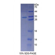 SDS-PAGE analysis of Human PALLD Protein.