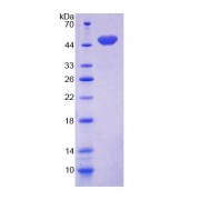 SDS-PAGE analysis of Human CD164 Protein.