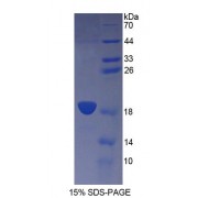 SDS-PAGE analysis of Mouse CD164 Protein.