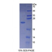 SDS-PAGE analysis of Human PLCb1 Protein.