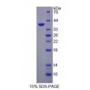 SDS-PAGE analysis of Rat GROg Protein.