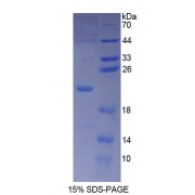 SDS-PAGE analysis of Human PLCb3 Protein.