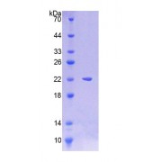 SDS-PAGE analysis of Human LAMP3 Protein.