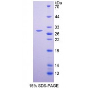 SDS-PAGE analysis of recombinant Human KCC4 Protein.