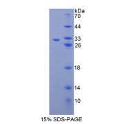 SDS-PAGE analysis of Human PGAM2 Protein.