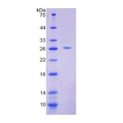 SDS-PAGE analysis of Rat CACT Protein.