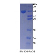 SDS-PAGE analysis of Rat AGTR1 Protein.