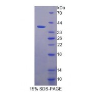 SDS-PAGE analysis of Human MLYCD Protein.