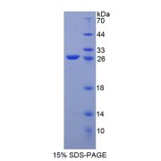 SDS-PAGE analysis of Human KEL Protein.