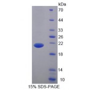 SDS-PAGE analysis of Mouse BTLA Protein.