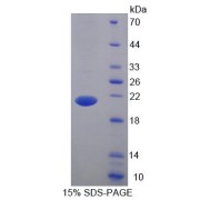 SDS-PAGE analysis of Mouse BTLA Protein.