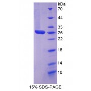 SDS-PAGE analysis of General STAT3 Protein.