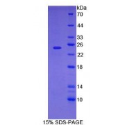 SDS-PAGE analysis of General STAT3 Protein.