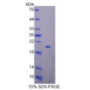 SDS-PAGE analysis of recombinant Mouse KLRK1 Protein.