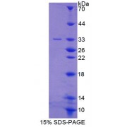 SDS-PAGE analysis of Human PTGFRN Protein.