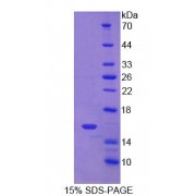 SDS-PAGE analysis of Human CD7 Protein.