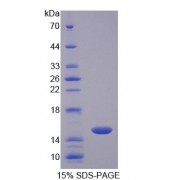 SDS-PAGE analysis of Rat CD7 Protein.