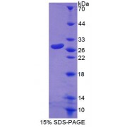 SDS-PAGE analysis of Human RND1 Protein.