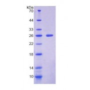 SDS-PAGE analysis of Mouse NCR1 Protein.
