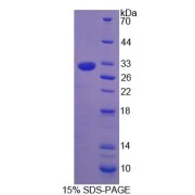 SDS-PAGE analysis of Rat NCR1 Protein.