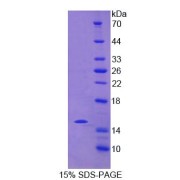 SDS-PAGE analysis of Human NCR2 Protein.