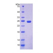 SDS-PAGE analysis of Human UPP1 Protein.