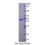 SDS-PAGE analysis of Human SCCA1/SCCA2 Protein.
