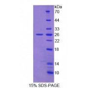 SDS-PAGE analysis of Mouse SLAMF2 Protein.