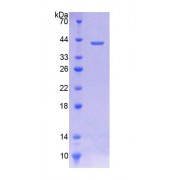 SDS-PAGE analysis of Human CTL1 Protein.