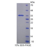 SDS-PAGE analysis of Mouse CD19 Protein.