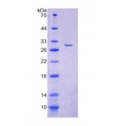 SDS-PAGE analysis of Human FOXP3 Protein.
