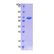 SDS-PAGE analysis of Rat IL7R Protein.