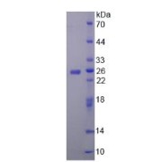 SDS-PAGE analysis of Human CHRNa4 Protein.