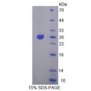 SDS-PAGE analysis of Mouse CHRNa4 Protein.