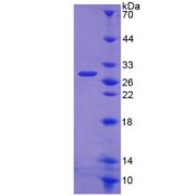 SDS-PAGE analysis of Human WASP Protein.