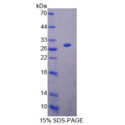 SDS-PAGE analysis of Mouse CHRNa2 Protein.