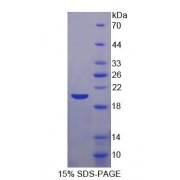SDS-PAGE analysis of Human FUM Protein.