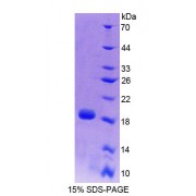 SDS-PAGE analysis of Mouse FUM Protein.