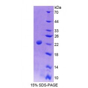 SDS-PAGE analysis of Rat Sp17 Protein.
