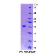 SDS-PAGE analysis of Rat Sp17 Protein.