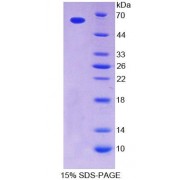 SDS-PAGE analysis of Human tPK1 Protein.