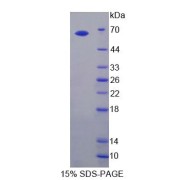 abx168805