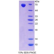 SDS-PAGE analysis of Rat TLR5 Protein.